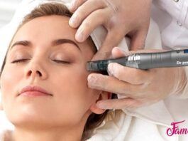 técnica del microneedling beneficios